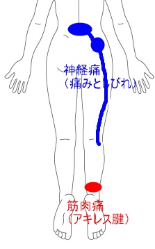 人体イラスト-女性.jpg