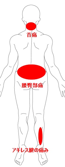 症例イラスト１.jpg