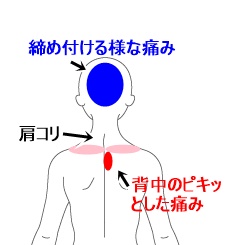 背中 コリ