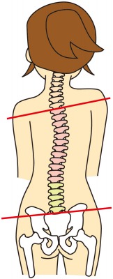背骨の歪み.jpg