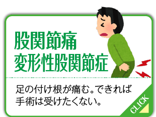 股関節痛、変形性股関節症